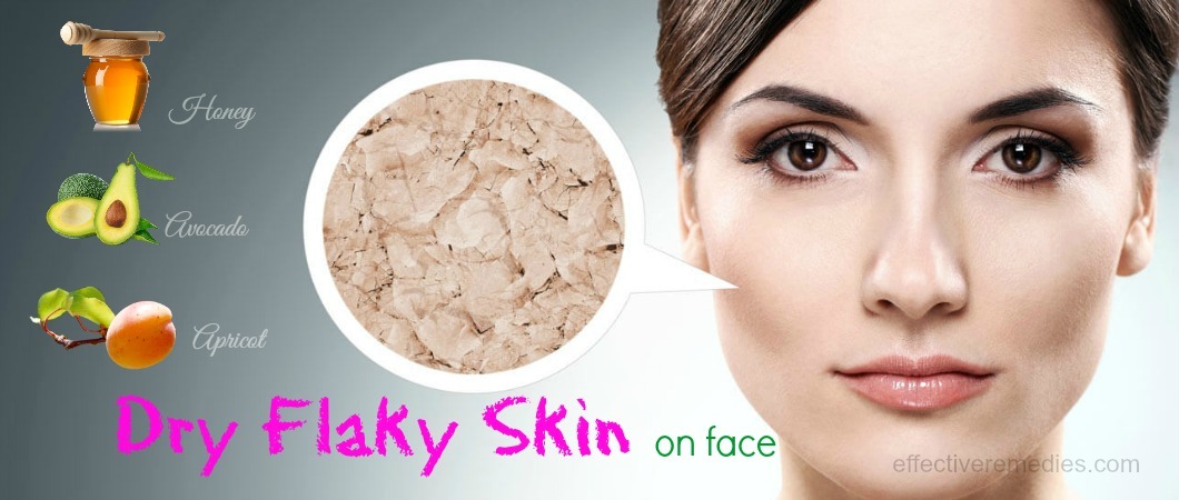 How to Treat Dry, Flaky Skin on Your Face