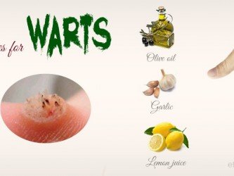 home remedies for warts