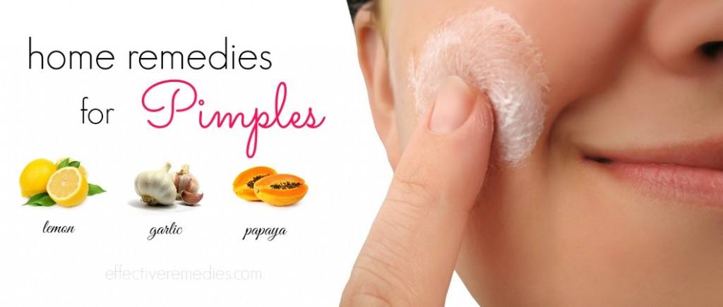 home remedies for pimples