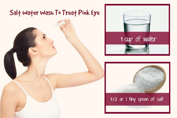 home remedies for pink eye 