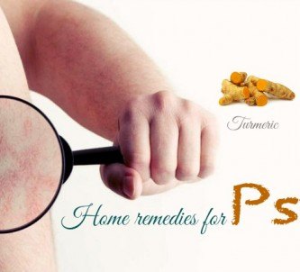 home remedies for psoriasis