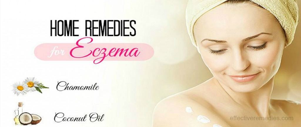 home remedies for eczema