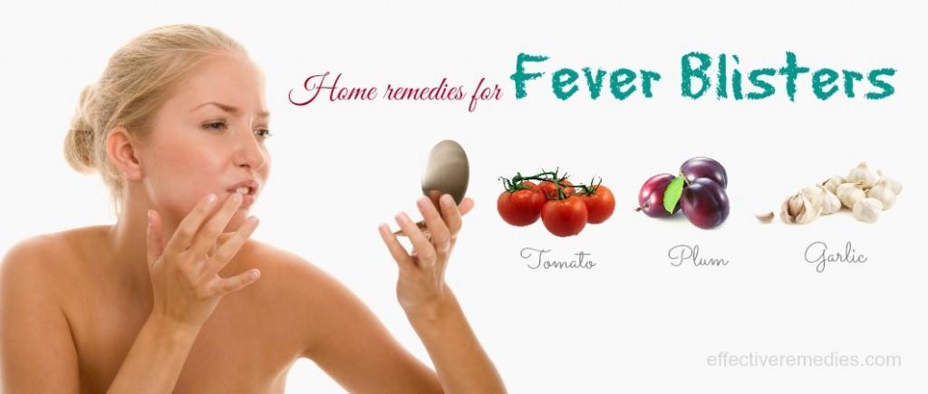 home remedies for fever blisters