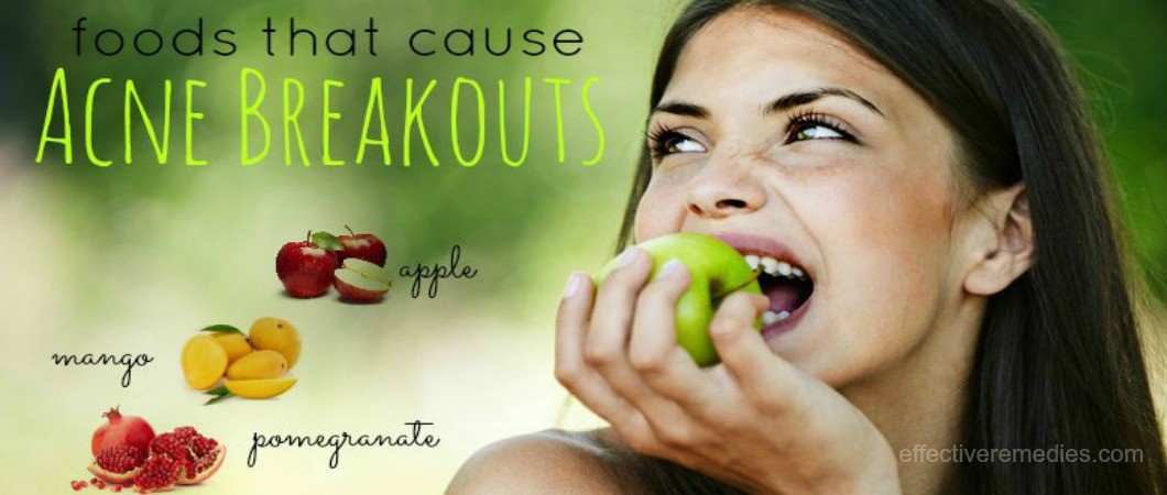 foods that cause acne breakouts