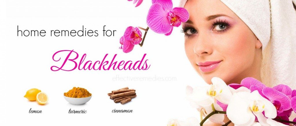 home remedies for blackheads