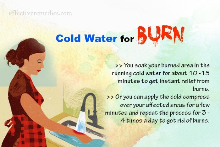 home-remedies-for-burns