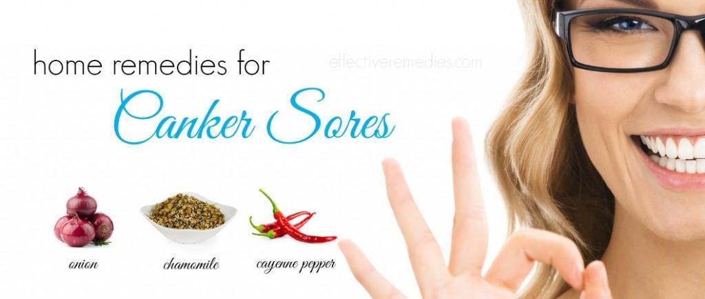 home remedies for canker sores