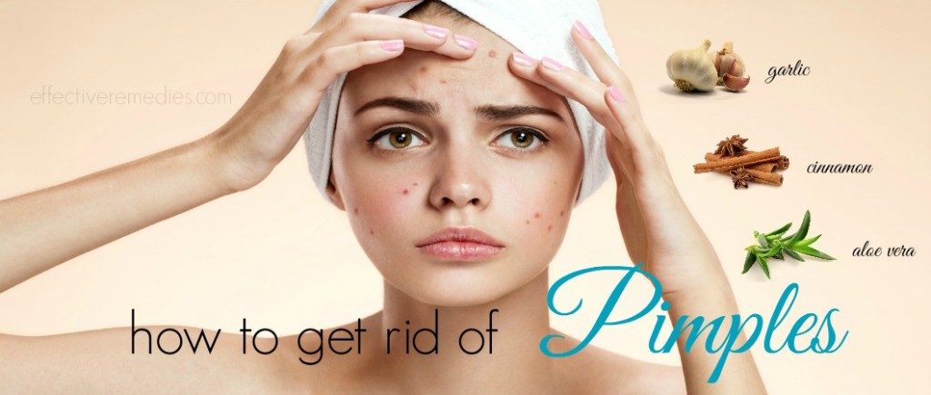 How to get rid of pimples