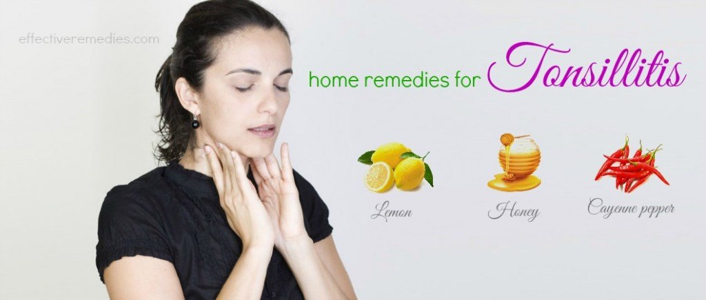 home remedies for tonsillitis