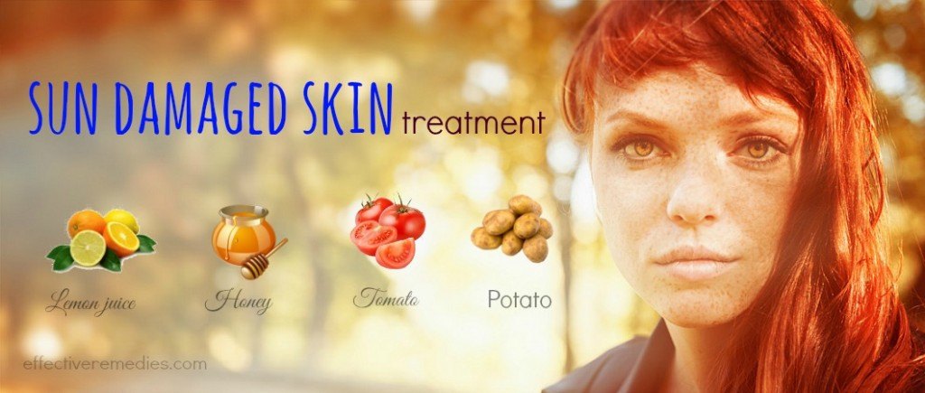 sun damaged skin treatment