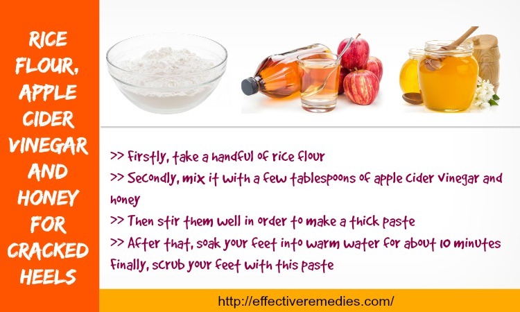 home remedies For Cracked Heels