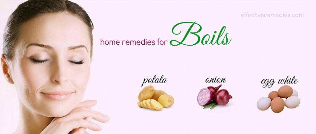 home remedies for boils