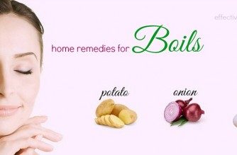 home remedies for boils