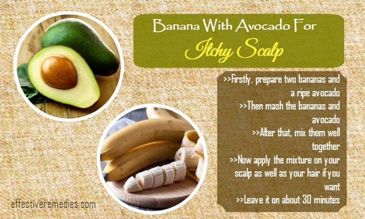 home-remedies-for-itchy-scalp