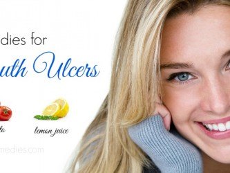 home remedies for mouth ulcers