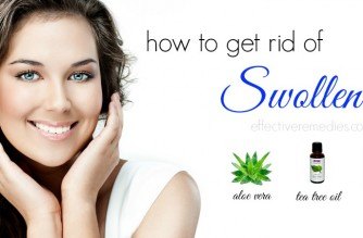 how to get rid of swollen lip