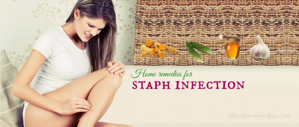 home remedies for staph infection