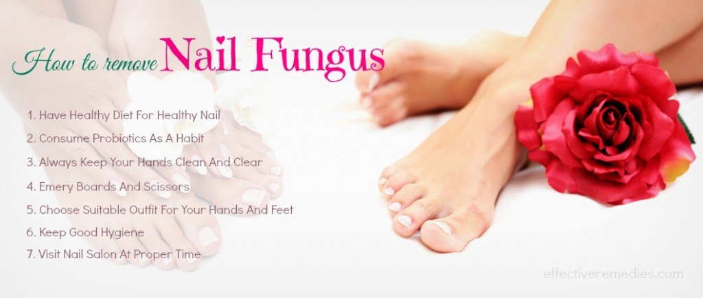 how to remove nail fungus