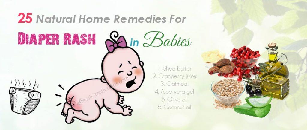 home remedies for diaper rash