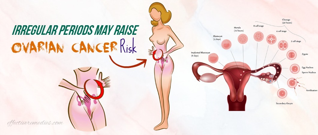 Irregular Periods May Raise Ovarian Cancer Risk