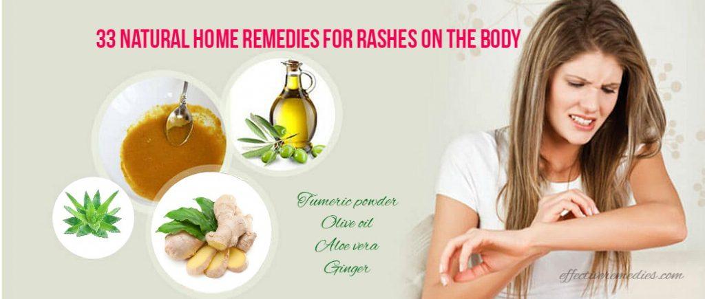 home remedies for rashes