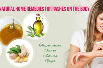 home remedies for rashes