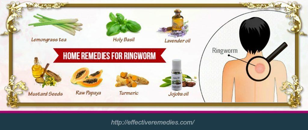 home remedies for ringworm