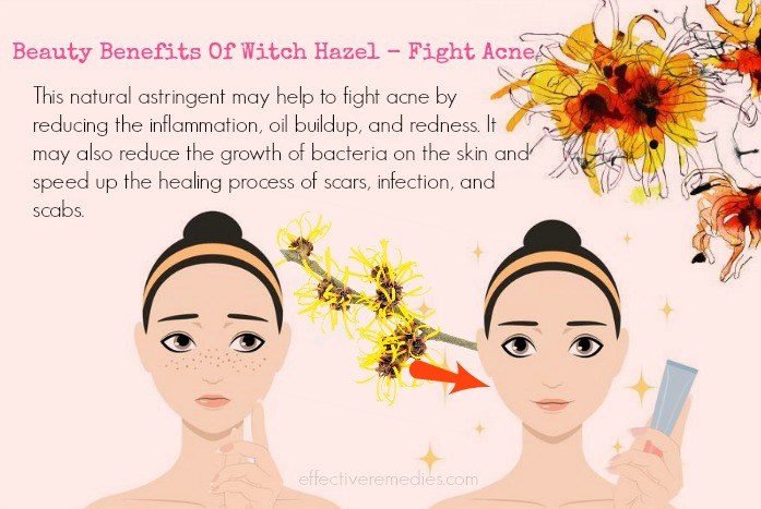 Beauty Benefits Of Witch Hazel