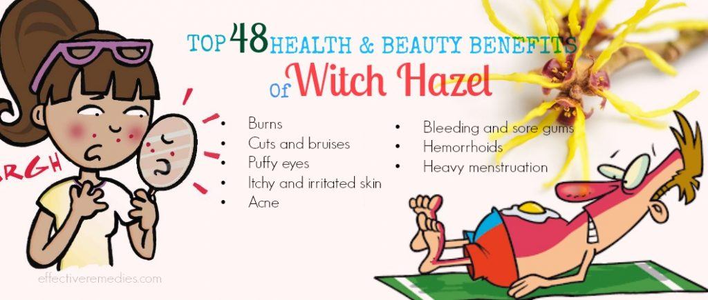 benefits of witch hazel