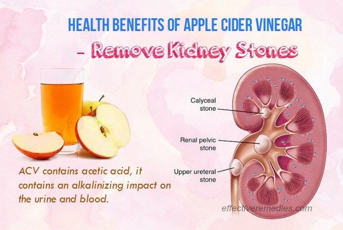 health benefits of apple cider vinegar 