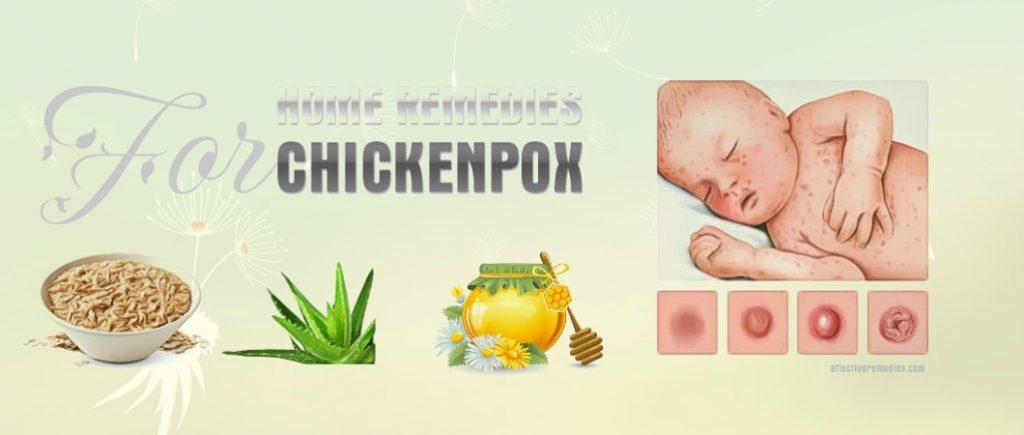 home remedies for chickenpox