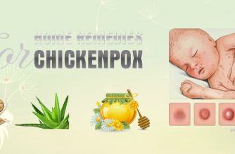 home remedies for chickenpox