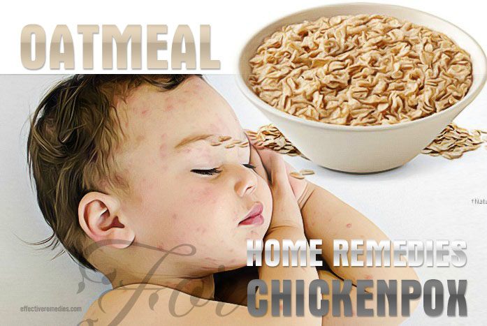 home remedies for chickenpox - oatmeal