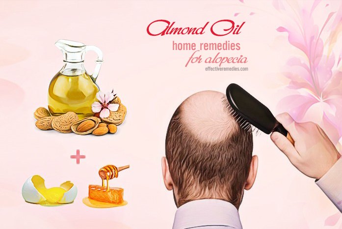 home remedies for alopecia - almond oil