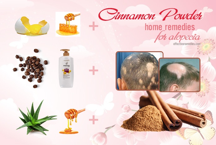 home remedies for alopecia - cinnamon powder