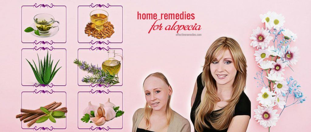 natural home remedies for alopecia