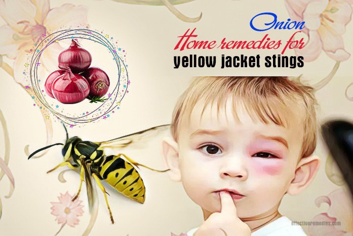 home remedies for yellow jacket stings - onion