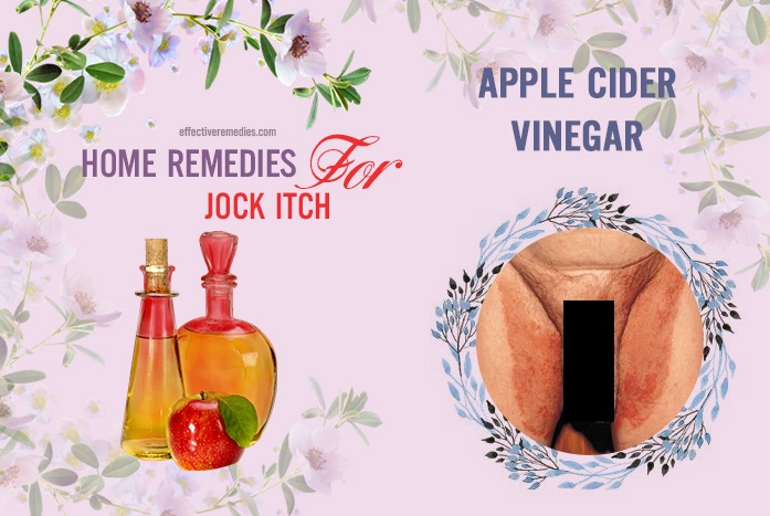 home remedies for jock itch - apple cider vinegar