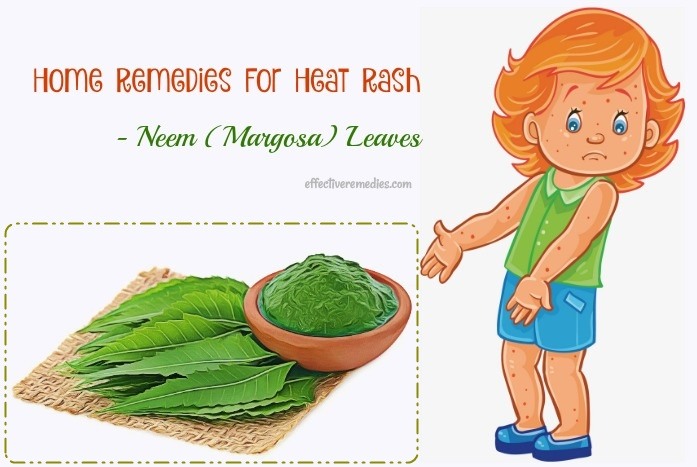 home remedies for heat rash - neem (margosa) leaves