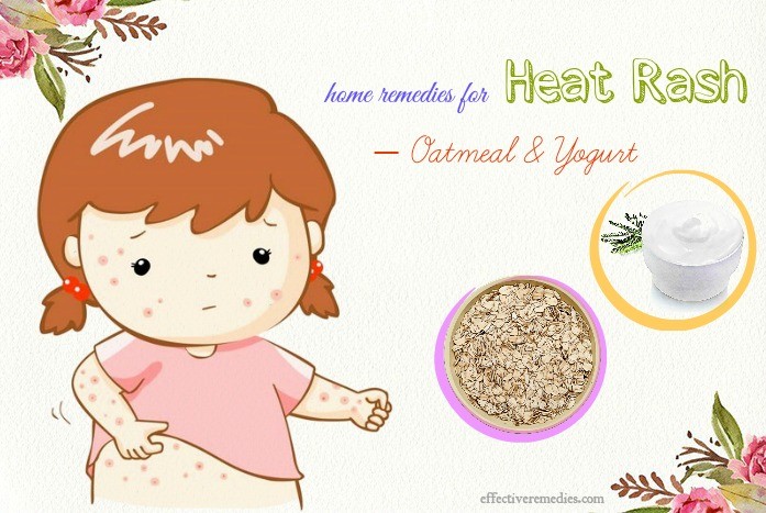 home remedies for heat rash - oatmeal & yogurt