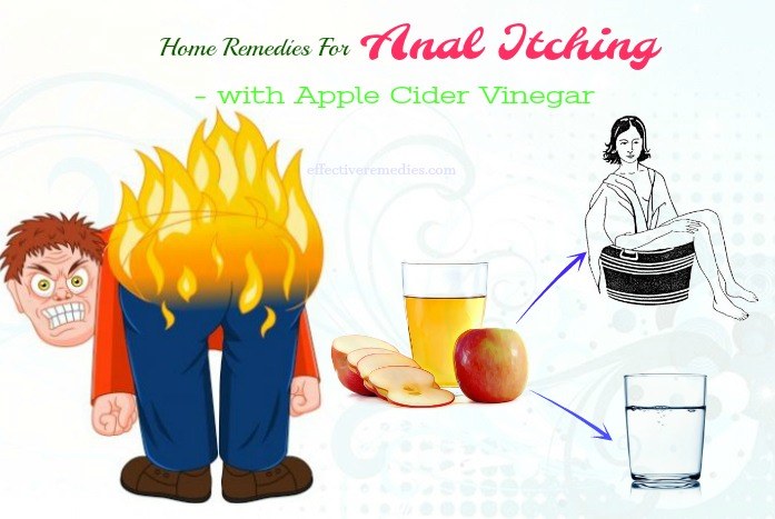 8 Best Home Remedies For Anal Itching 100 Natural And Safe 9250