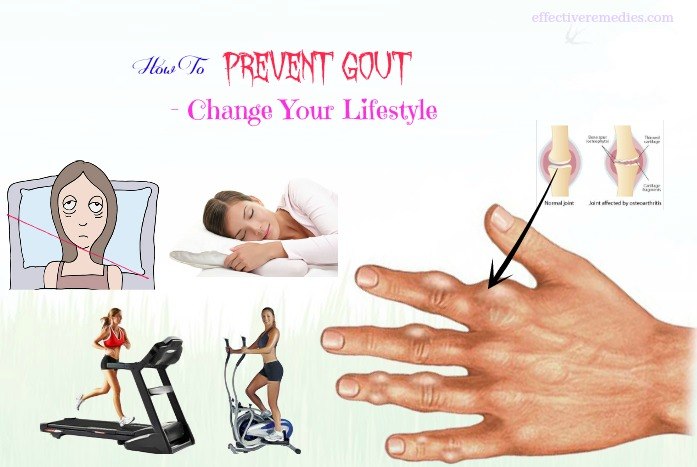 how to prevent gout - change your lifestyle