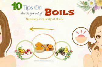 tips on how to get rid of boils