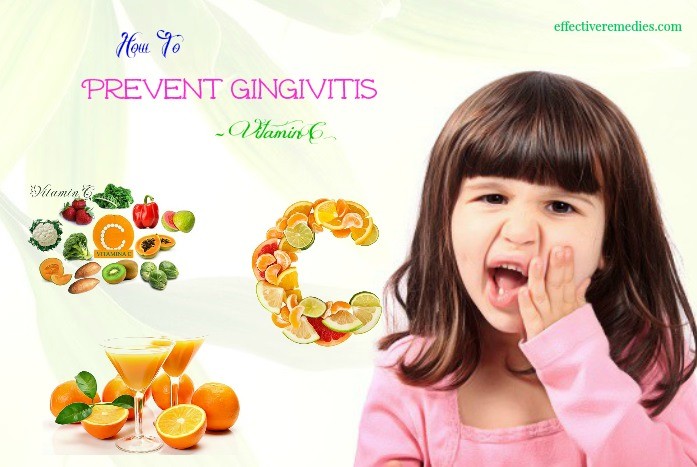 how to prevent gingivitis - vitamin c