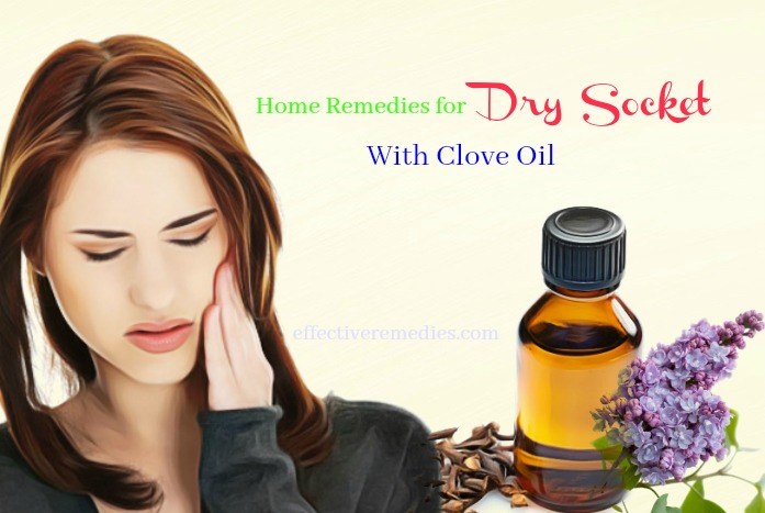 home remedies for dry socket pain - clove oil