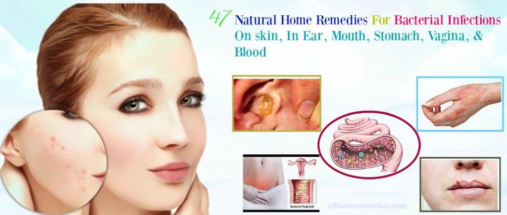 home remedies for bacterial infections on skin