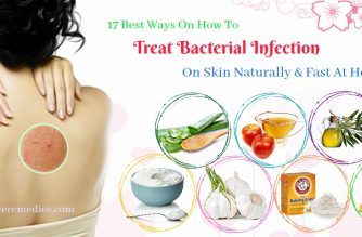 how to treat bacterial infection on skin