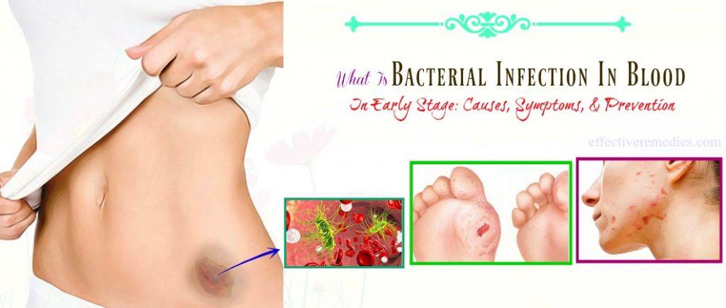 what is bacterial infection in blood in early stage