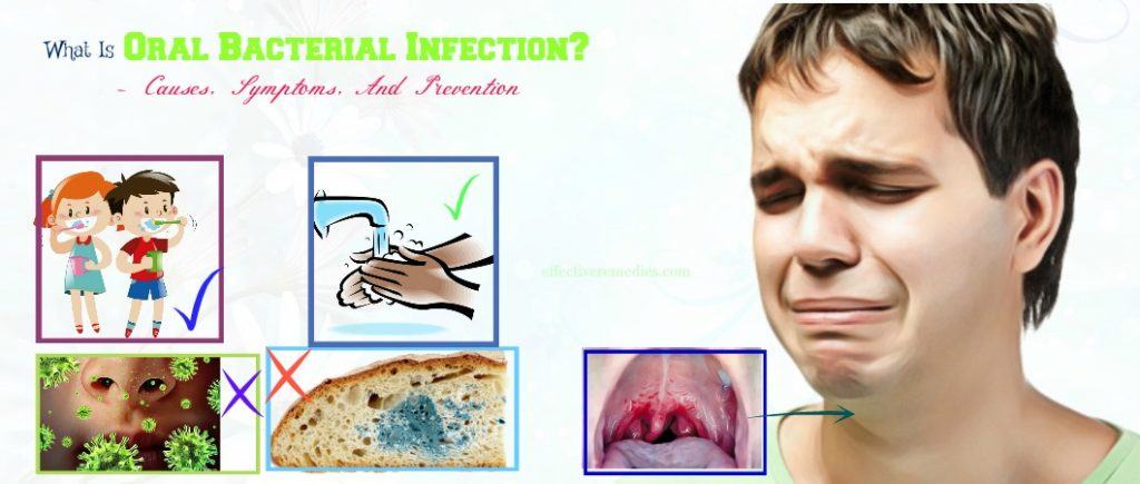 what is oral bacterial infection and causes