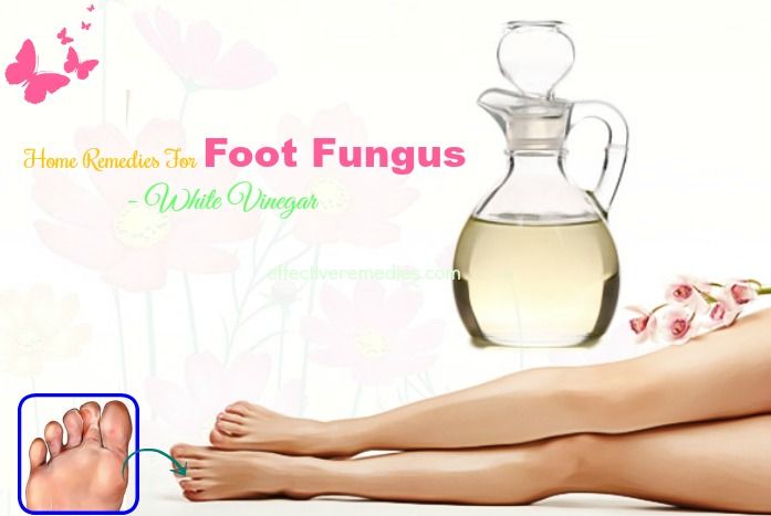 home remedies for foot fungus toenail fungus - white vinegar